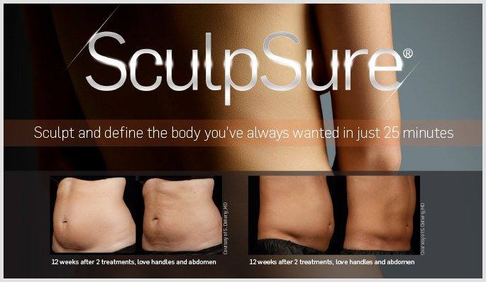SculpSure-Overview